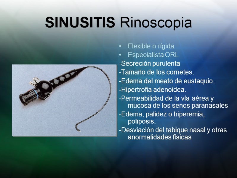 SINUSITIS Rinoscopia Flexible o rígida Especialista ORL -Secreción purulenta  -Tamaño de los cornetes.